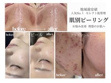 都度払い/通いやすい価格/選べるメニューを中心に展開☆