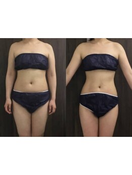 サイズダウンを目指したい