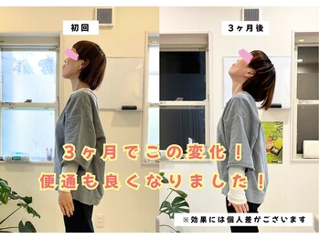 なかもず 輝き美容整体院/3ヶ月で上を向けた！
