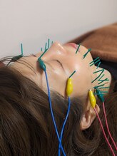 乃々鍼灸整体院 表参道/美容鍼