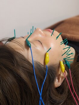 乃々鍼灸整体院 表参道/美容鍼