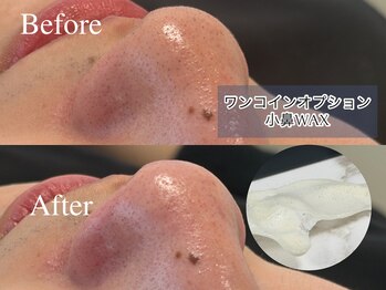 エサージュオム 銀座エスト店/小鼻WAX