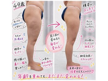アンジェ あゆむ鍼灸院/人気NO.1 Ange式メディセル施術