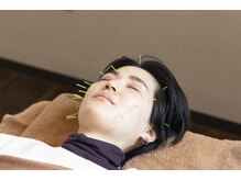 ラックス鍼灸 整体院(Lachs鍼灸 整体院)/美容鍼