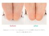 《サンダルを自信もって履ける足元に!》フット贅沢ケアコース ¥6600