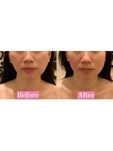 アジール 長岡リバーサイド千秋店(agir)/Before/After画像