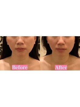 アジール 長岡リバーサイド千秋店(agir)/Before/After画像