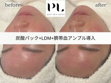 プル スキンサロン(pull skin salon)/