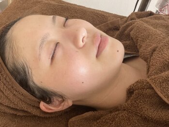 カーリー(KARLIE)の写真/お肌のお悩みや気になる箇所に徹底アプローチ◎お肌の状態やお悩みに合わせて施術をご提供致します!