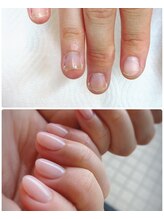 ココ ネイル サロン アンドスクール(COCO.NAIL SALON＆SCHOOL)/爪育成　2ヶ月経過　6650