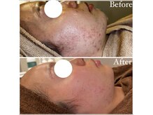 マドモアゼル 麻布十番の雰囲気（結果重視サロン♪毛穴/麻布十番/肌管理/ララピール/インディバ）