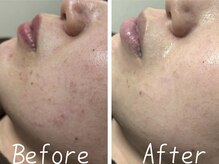 シャルム ココ 八尾店(Charme coco)