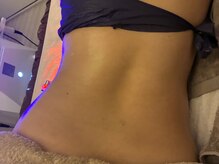 ナースのロミリンパ/