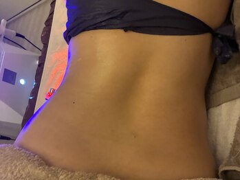 ナースのロミリンパ/