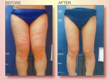 ジュリア オージェ 京橋店/ビフォーアフター（美脚）