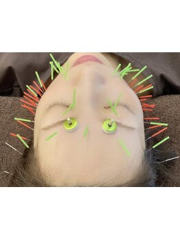 小顔になりたい