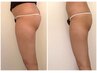 ≪骨盤底筋≫“ビジリス”で骨盤底筋&ヒップトレーニング◎