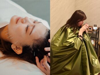 デルタエヌピー63+(δnp63+)の写真/【身体の内側から綺麗に】小顔美容鍼+国産よもぎとオーガーニックハーブで顔も体も美しく
