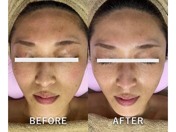 サロンドジェシカ(salon de Jessica)/お顔脱毛 シェービング付 