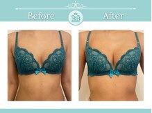 美人バスト 宇都宮店/★バストアップ症例/育乳★