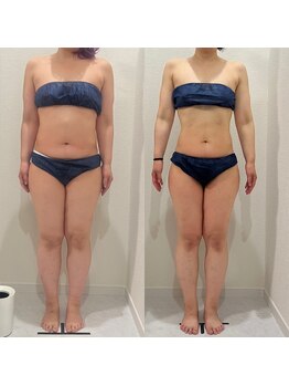 ヴィナーレ(VINARE)/全身キレイにサイズダウン