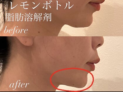 チアリス(chiariss)の写真