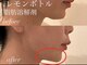 チアリス(chiariss)の写真