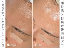 ゼアー(THERE FY.)/