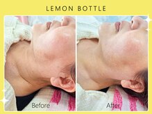 シロカネ 光の森店(SHIROKANE)/レモンボトル☆