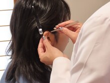 フー 松本 信州大学前店(FOO)の雰囲気(耳のつぼに専用の粒を貼ります。ハリは使わず、安心・安全です。)