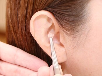 ルビー(Ruby)/施術(2)