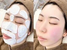 ホワイトアイ 堺東(WHITE EYE)