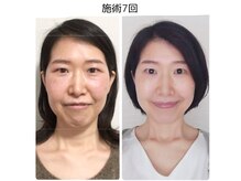トッコボディケアの雰囲気（垢抜けていく小顔矯正でもっと綺麗に！）