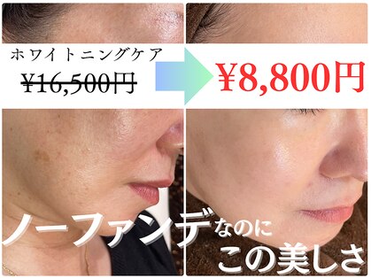 パールホワイトニングサロン 茅ヶ崎店の写真