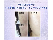 サロンファーストタッチ(Salon First Touch)の雰囲気（シミケアだからこそ叶う、ダウンタイムなし！即時メイクOK！）