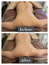 マンダ 田町(Manda)/肩こり、背中のハリを改善！