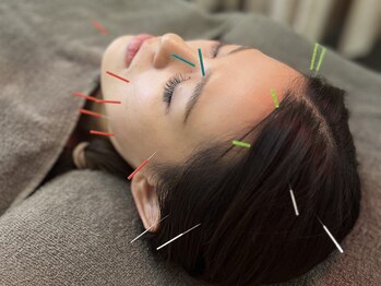 八軒さきがけ鍼灸整体院/大事なイベント前にも♪美容鍼灸
