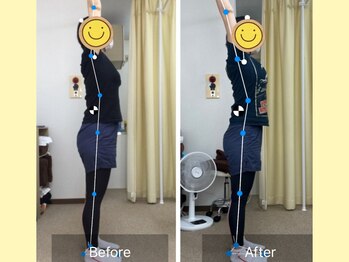 ナオル整体 春日部院(NAORU整体)/腕がラクラク上がる!