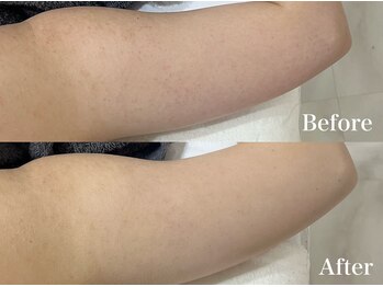 マシェ バイ マユ(Mache by Mayu)/長年のブツブツは当店のハーブ！