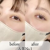 ルナドットアイ(LUNA.eye)