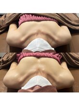 ロココ 豊田店(Rococo)/ビフォーアフター