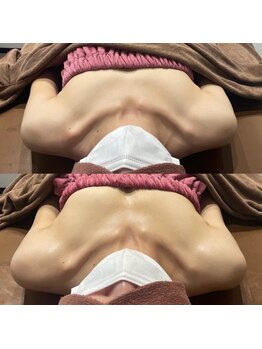 ロココ 豊田店(Rococo)/ビフォーアフター