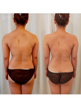 ミールーム(mi room)/ブライダルエステ２ヶ月半