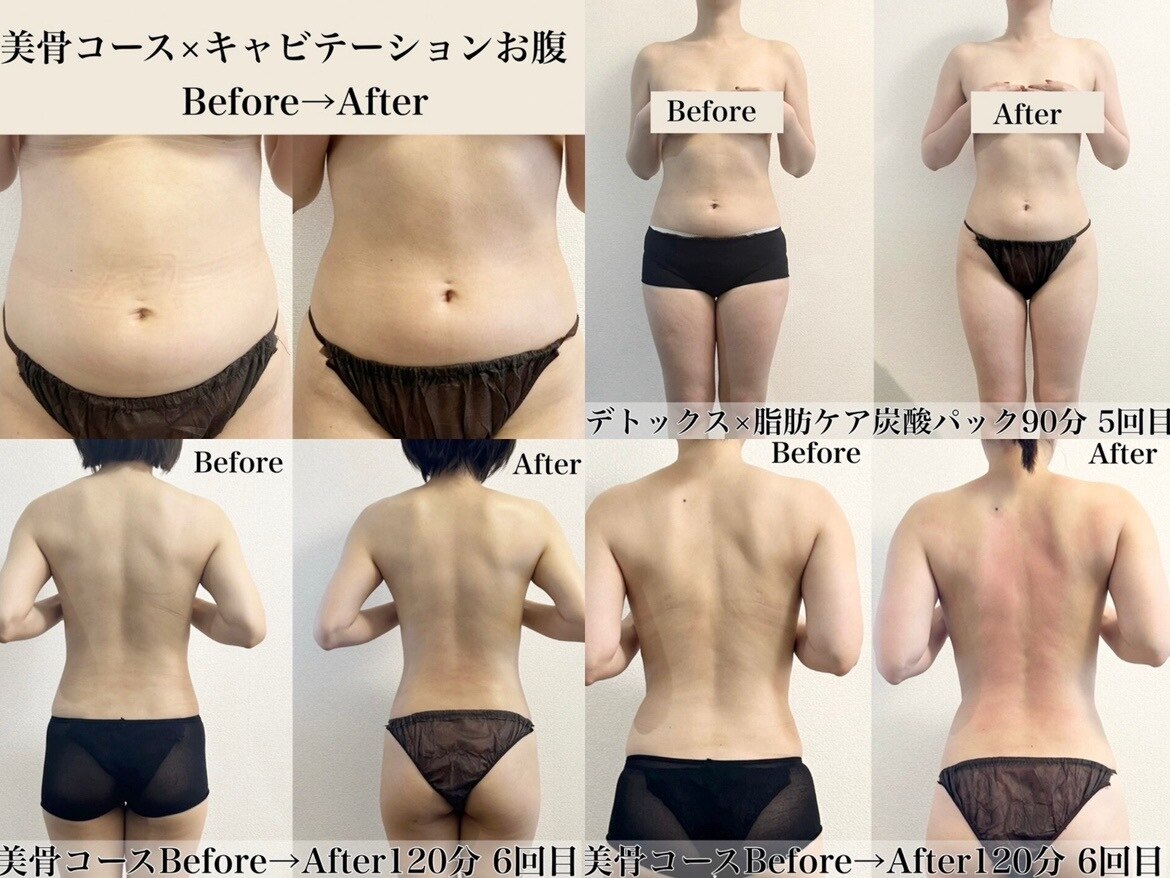 アトレセカンドボディ(Attrait second body)｜ホットペッパービューティー