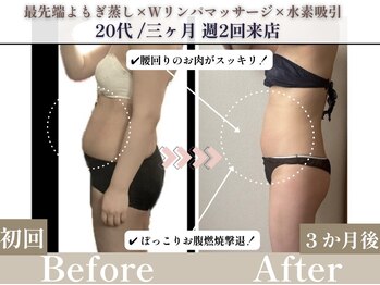 ヨサパーク カリーナ(YOSA PARK carina)/お客様BEFOR・AFTER