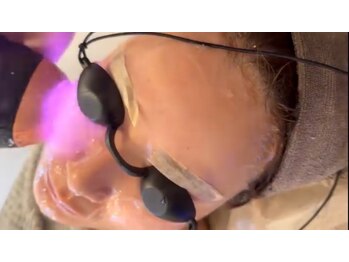 アルページュ(Arpege)の写真/韓国HIT紫光束の連射エステ版チタニウムリフト♪シミに反応する光ケアで毛穴レス小顔/肌改善も同時に叶う