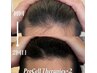 【育毛促進・頭頂部のお悩みをサロンで◎】頭皮改善トリートメント ￥50000