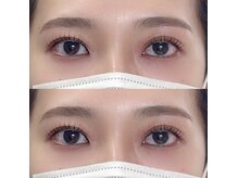 ユウワ(yuwa)/ラッシュリフト＆美眉