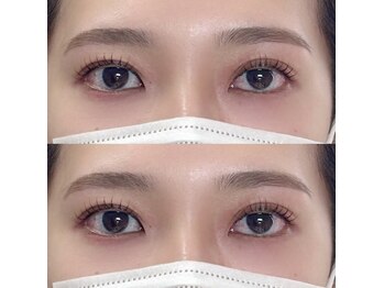 ユウワ(yuwa)/ラッシュリフト&美眉