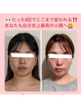 真美(Sinbi)/リターンフェイシャル